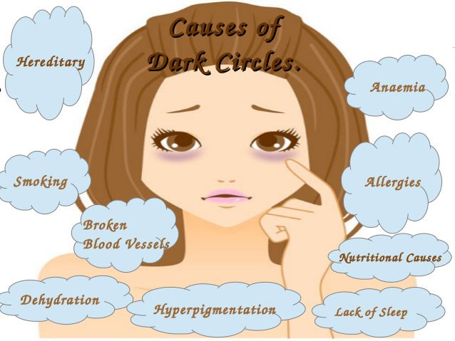 Ways to Get Rid of Dark Circles Under Eyes